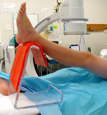 C-Thru Leg Triangle Leg Prepper